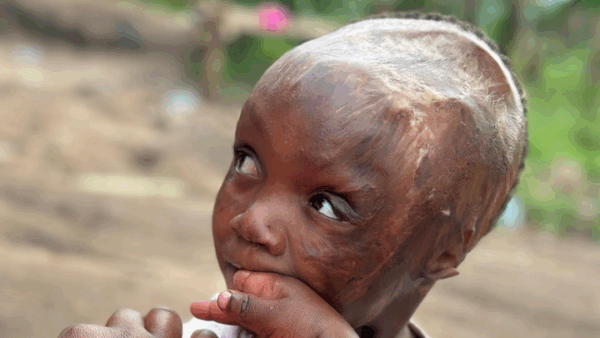 https://sadik-o.com - Support Winnie’s Critical Surgery