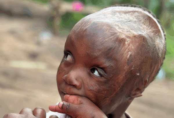 https://sadik-o.com - Support Winnie’s Critical Surgery