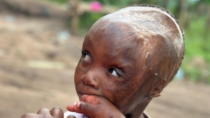 Support Winnie’s Critical Surgery