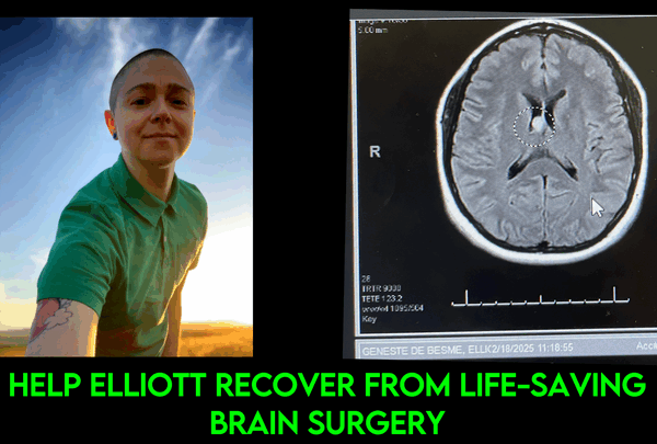 https://sadik-o.com - Support Elliott's Recovery from Life Saving Brain Surgery
