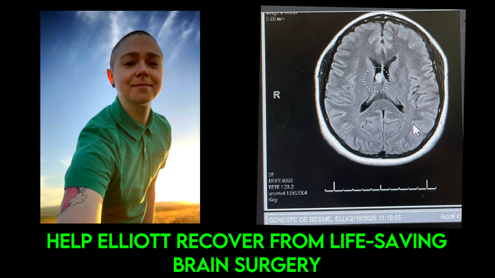 Support Elliott’s Recovery from Life Saving Brain Surgery