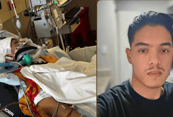 https://sadik-o.com - Support Ronav Subedi's Recovery After Severe Car Accident