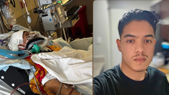 Support Ronav Subedi’s Recovery After Severe Car Accident