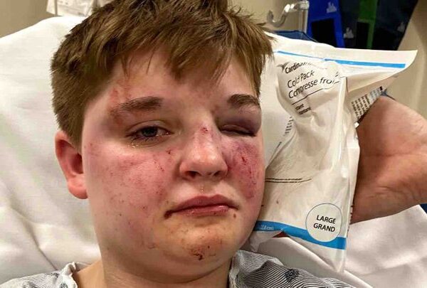 https://sadik-o.com - Support Kady Grass After Brutal Attack