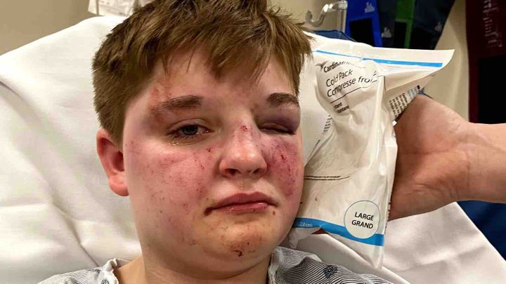 Support Kady Grass After Brutal Attack