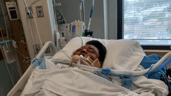 https://sadik-o.com - Stand by Arty After His Accident