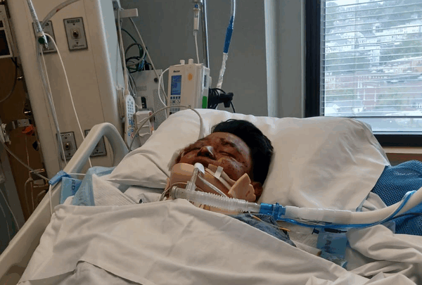 https://sadik-o.com - Stand by Arty After His Accident