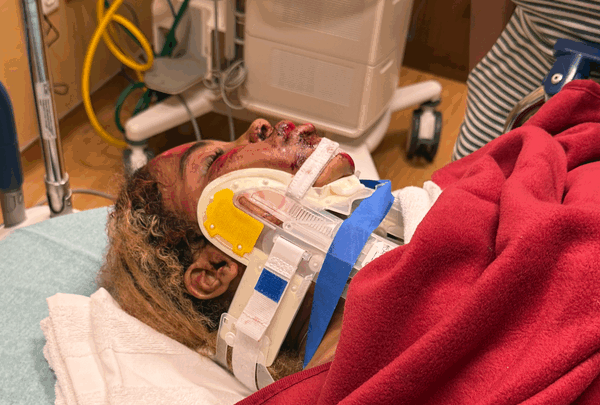 https://sadik-o.com - Help Aniyah Heal After a Tragic Accident
