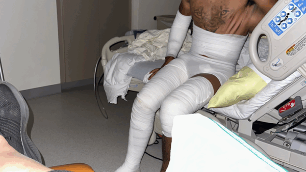https://sadik-o.com - Craig’s Road To Recovery