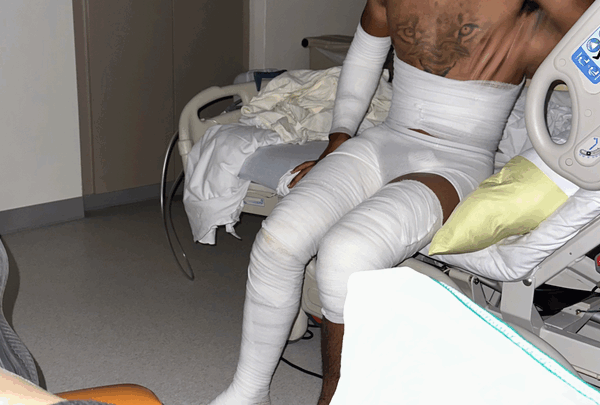 https://sadik-o.com - Craig’s Road To Recovery