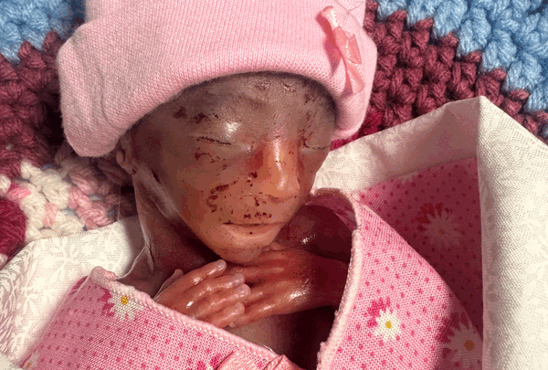 https://sadik-o.com - Help Ericka and Nathaniel with this heart breaking loss