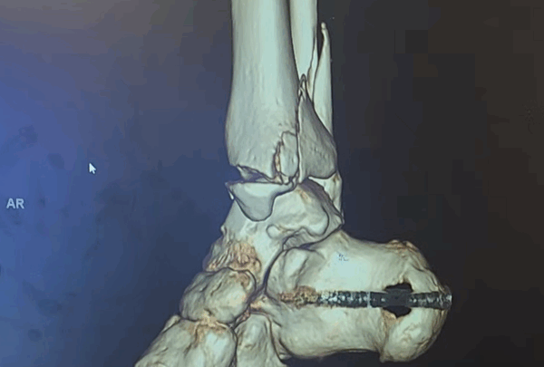 https://sadik-o.com - Killean's Surgeries for Broken