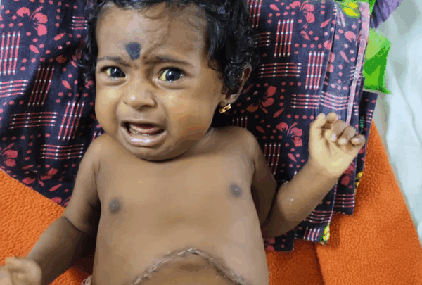 https://sadik-o.com - Support Baby Lakshmi Lalitha's Liver Transplant