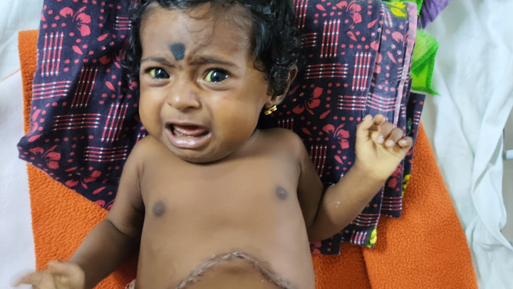 Support Baby Lakshmi Lalitha’s Liver Transplant