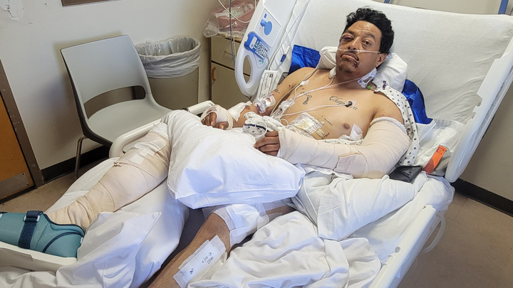 Help Noe Bernal’s Dad Recover from Tragedy