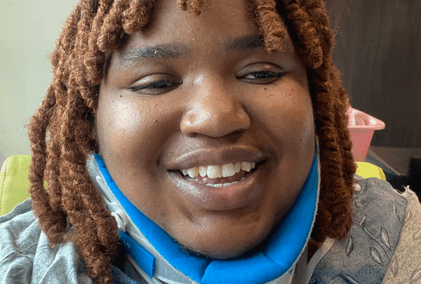 https://sadik-o.com - Support Eshe’s Recovery after Near Fatal Car Accident
