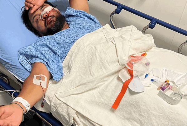 https://sadik-o.com - Support Isaac's Medical Bills After Accident