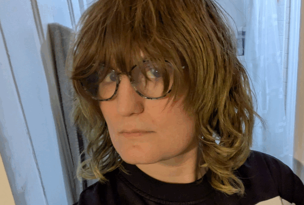 https://sadik-o.com - Help Melody afford Facial Feminization Surgery