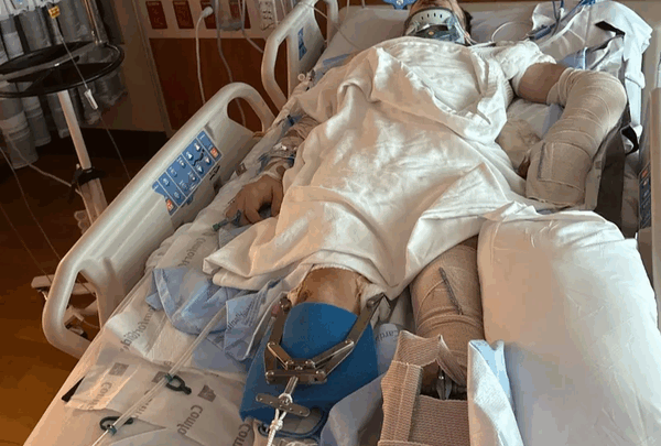 https://sadik-o.com - Support Matthew's Recovery after Motorcycle Accident