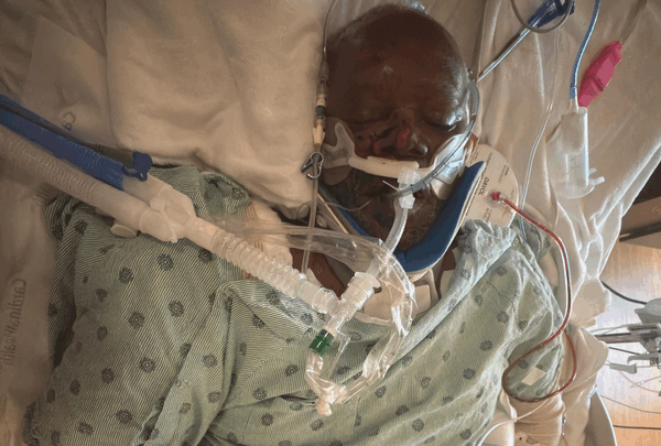 https://sadik-o.com - Support Joseph Matthew's (T-boy) Critical Recovery