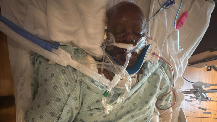 Support Joseph Matthew’s (T-boy) Critical Recovery