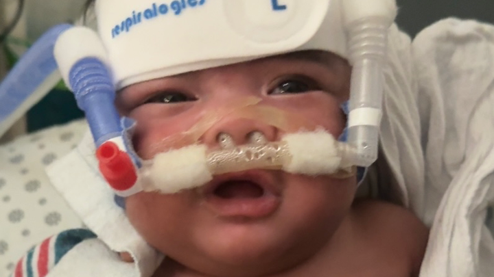Aid Baby Giovanni’s NICU journey—Every Dollar Counts