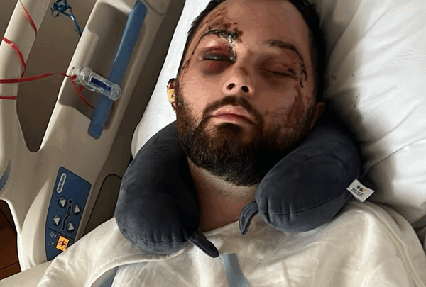 https://sadik-o.com - Support Brady Garrison's Road to Recovery