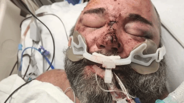 https://sadik-o.com - Support Marcus's Rehabilitation Journey