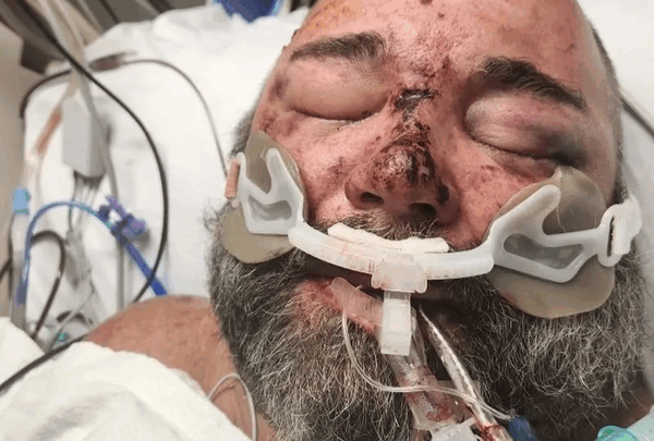 https://sadik-o.com - Support Marcus's Rehabilitation Journey