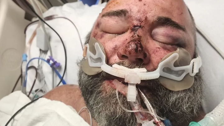 Support Marcus’s Rehabilitation Journey