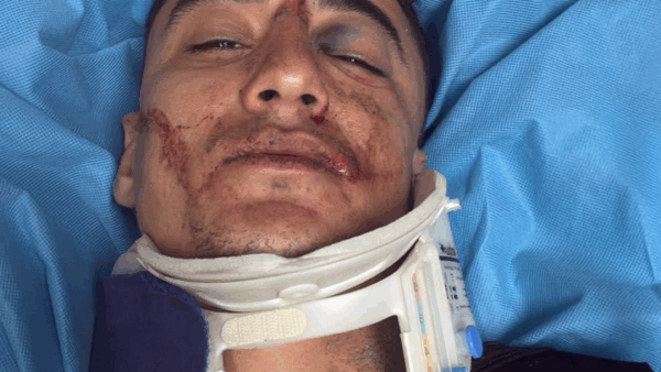 https://sadik-o.com - Support Kevin's Recovery: 13 Broken Bones
