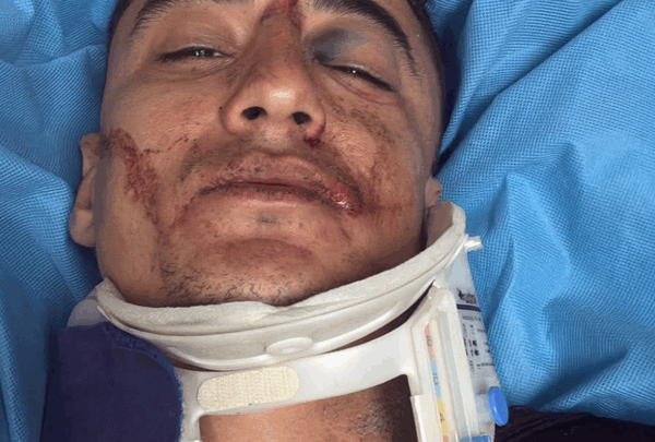 https://sadik-o.com - Support Kevin's Recovery: 13 Broken Bones