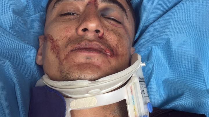 Support Kevin’s Recovery: 13 Broken Bones