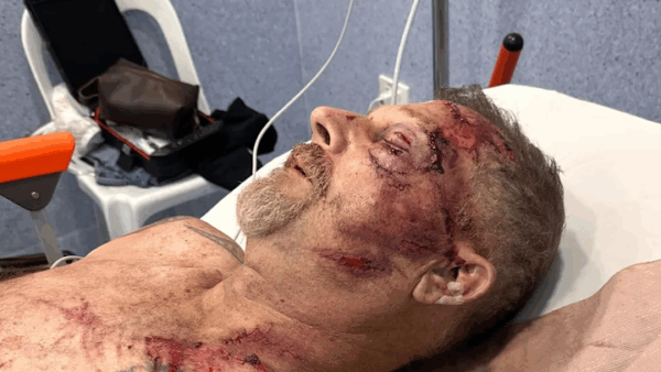 https://sadik-o.com - Urgent Help for Mark and Cole Haury’s Medical Crisis
