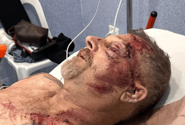 https://sadik-o.com - Urgent Help for Mark and Cole Haury’s Medical Crisis