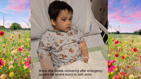 https://sadik-o.com - Help Little Mikele Heal After a Devastating Accident