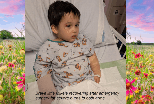 https://sadik-o.com - Help Little Mikele Heal After a Devastating Accident