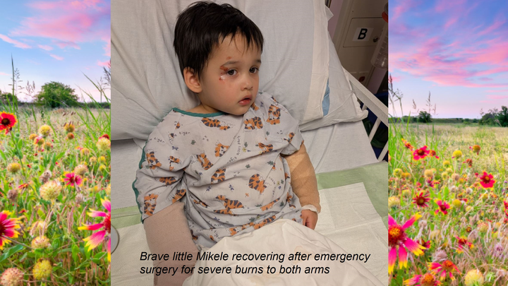 Help Little Mikele Heal After a Devastating Accident