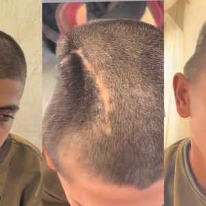 Help Heal His Broken Skull - – Sadik-O