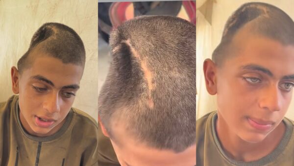 Help Heal His Broken Skull - – Sadik-O