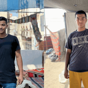 https://sadik-o.com - refugees and asylum seeekers - Help Anas get surgery and a prosthetic arm