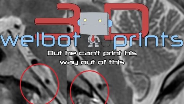 Help Welbot get back on his feet - – Sadik-O