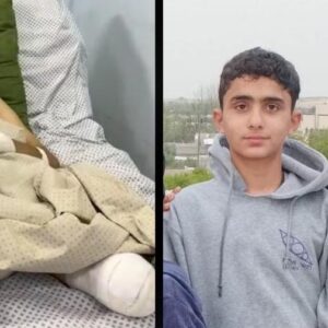 Help Ahmed Purchase Prosthetic Limbs - – Sadik-O