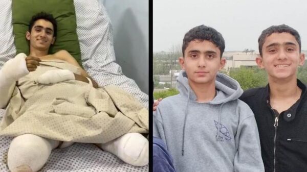 Help Ahmed Purchase Prosthetic Limbs - – Sadik-O