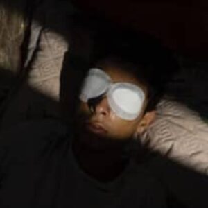Help Taha See again - – Sadik-O