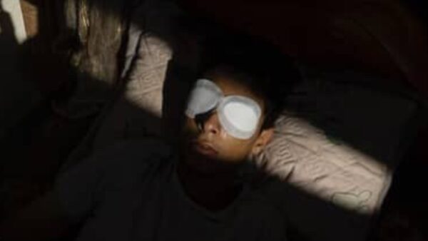 Help Taha See again - – Sadik-O