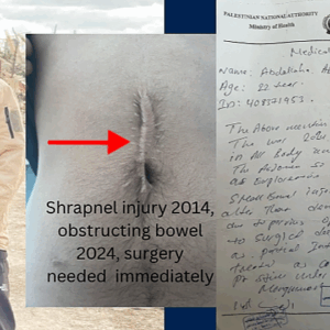 Shrapnel Still Inside: Give Abdullah in Gaza a Chance to Heal - – Sadik-O