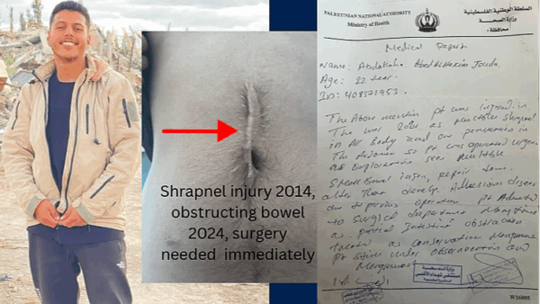 Shrapnel Still Inside: Give Abdullah in Gaza a Chance to Heal - – Sadik-O