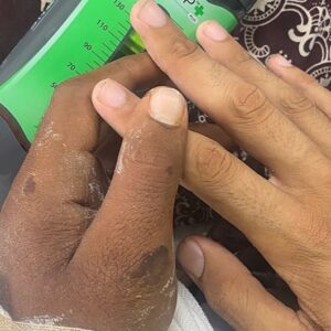 Help Mahmoud Heal and Study Medicine - – Sadik-O