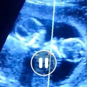 Medical Expenses for John Ryman’s Twins - – Sadik-O